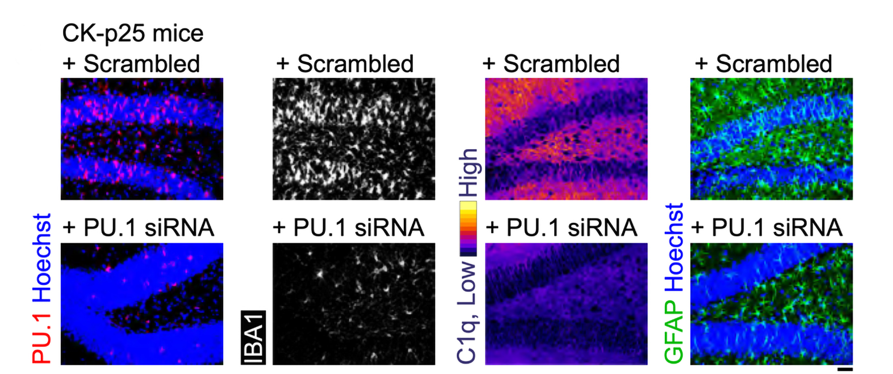 A 4x2 set of eight panels show highly colorful tissues. The bottom row is labeled siRNA while the top is a "scrambled' control. The various colored stains for inflammatory proteins are brighter in the top row than the bottom row.