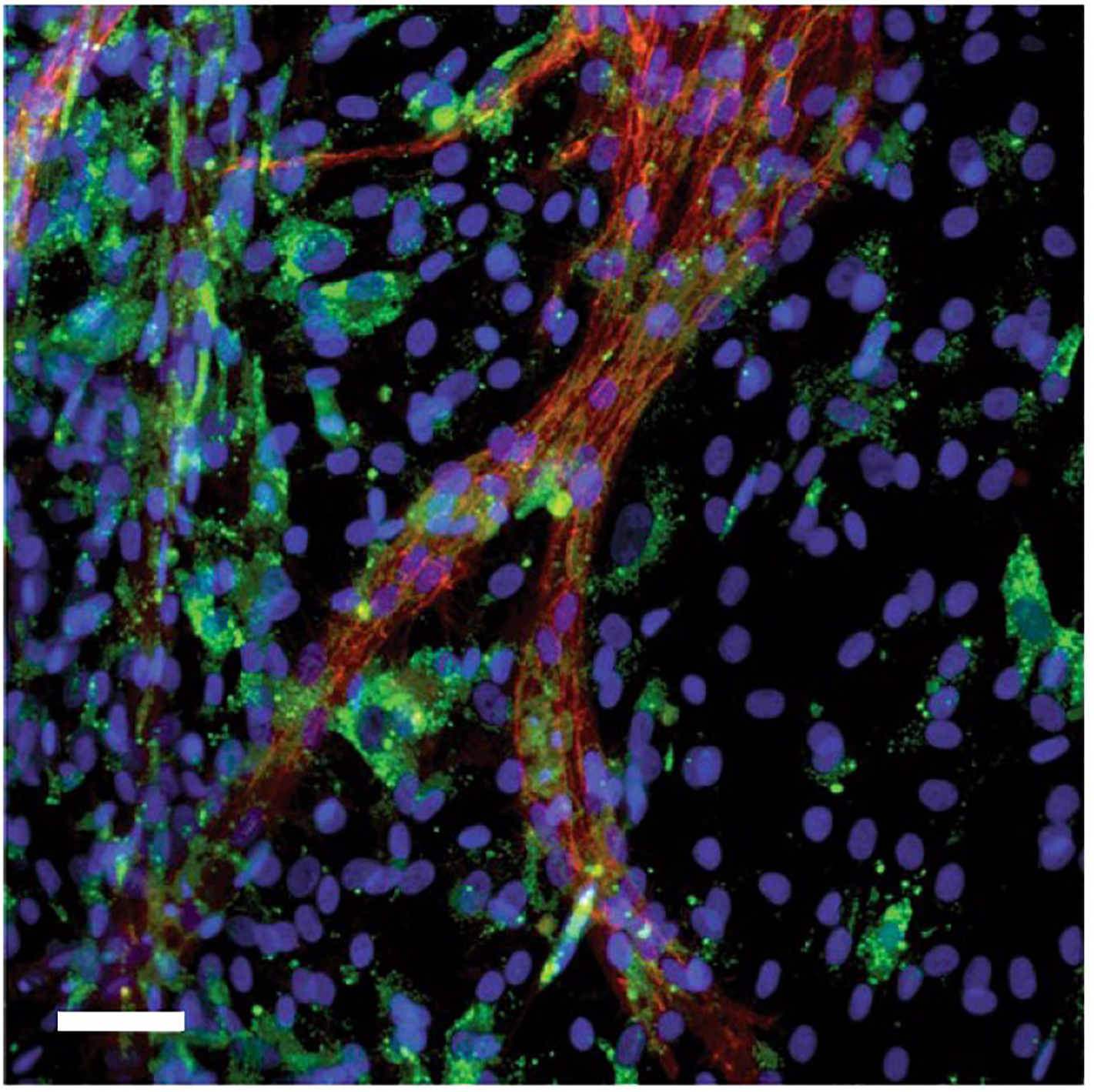 A branching blood vessel slants from bottom left to top right amid blue stained cells on a black background