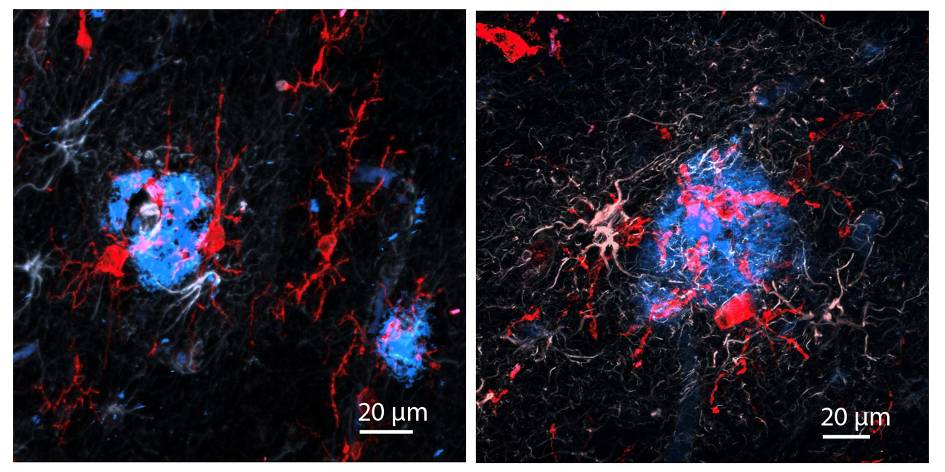 Decoding the complexity of Alzheimer’s disease