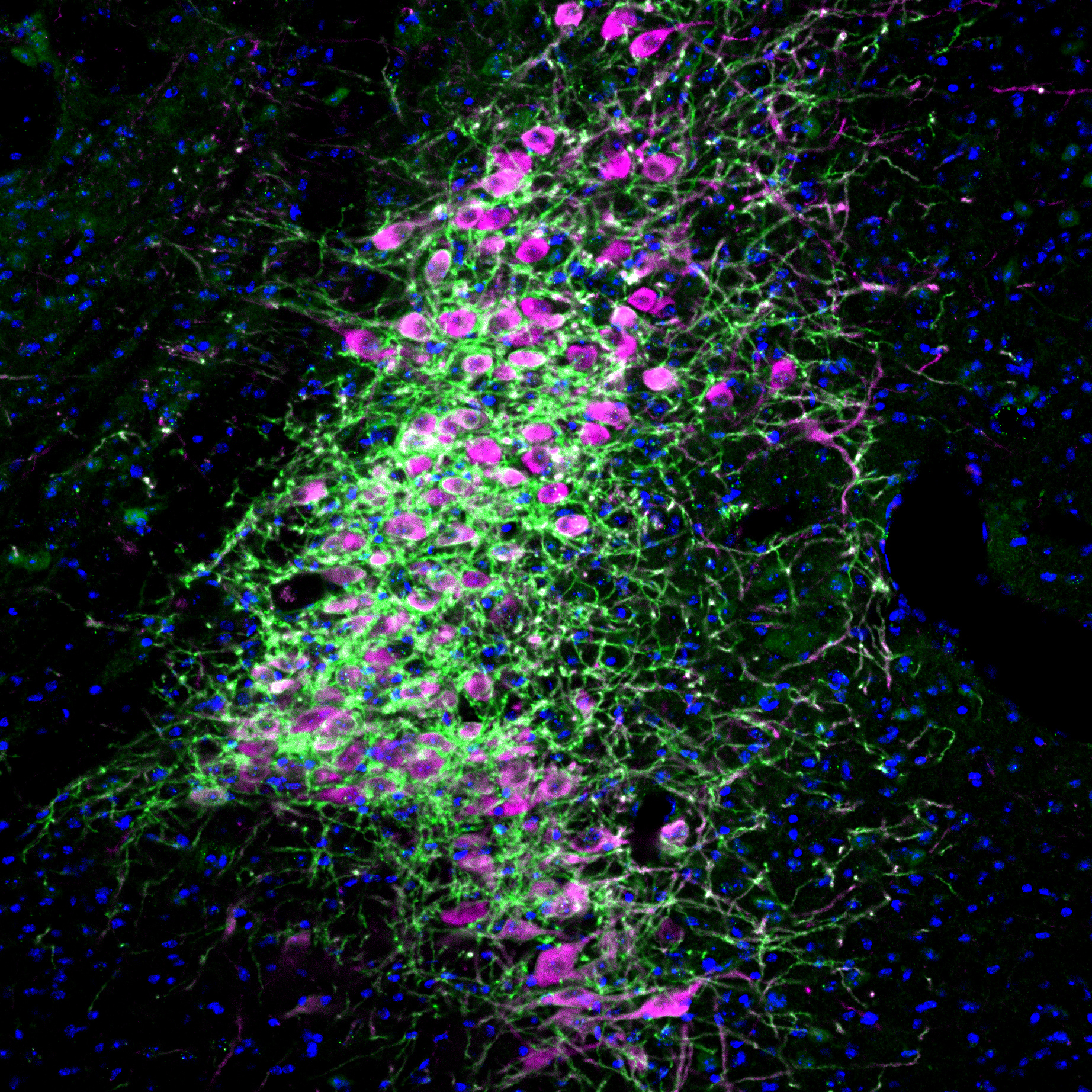 magenta cells with green extensions appear over a black background