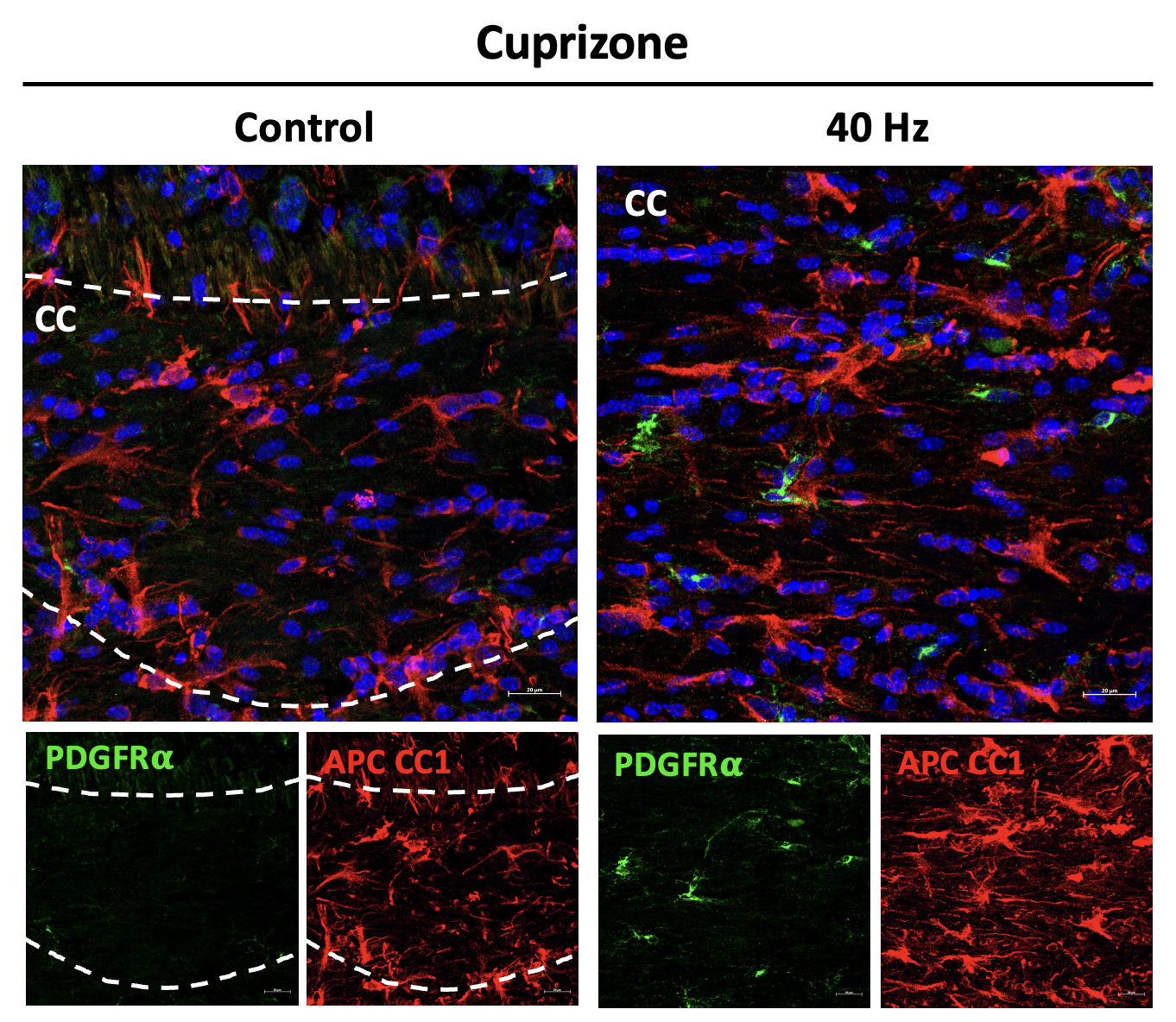 Side by side panels labeled cuprizone control and cuprizone 40hz compare amounts of cells stained red and green. The 40Hz panel shows much more red and green staining.