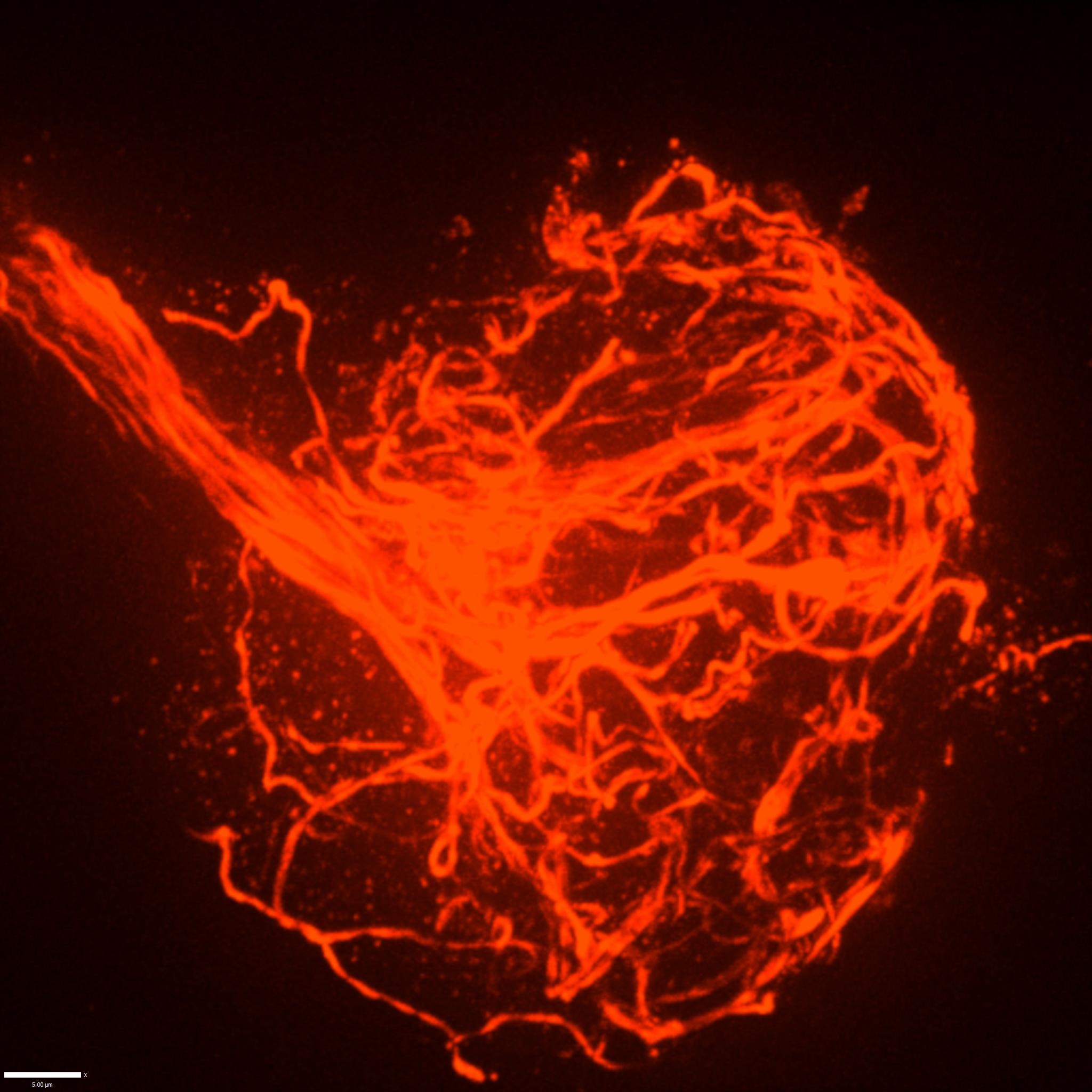 On a black background a tight bundle of red tubes extends from the top right corner into the middle of the image. In the middle the tubes fan out and then become wild and tangled in sort of a ball shape.