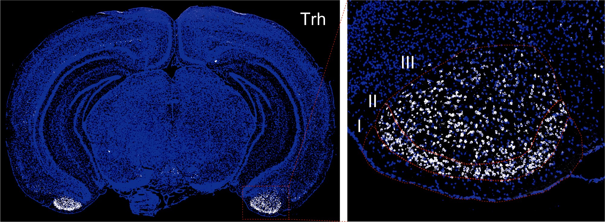 Microscope images show a blue-stained mouse brain. At the bottom on each side are cells shining white. A second panel shows higher magnification of that area