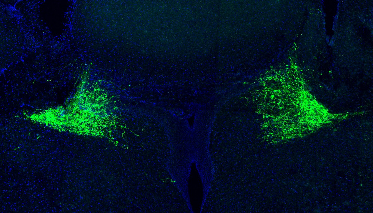 Within a horizontally oriented section of mouse brain stained deep blue cells in triangular, fan-shaped arrangements glow bright green on either side, mirroring each other.