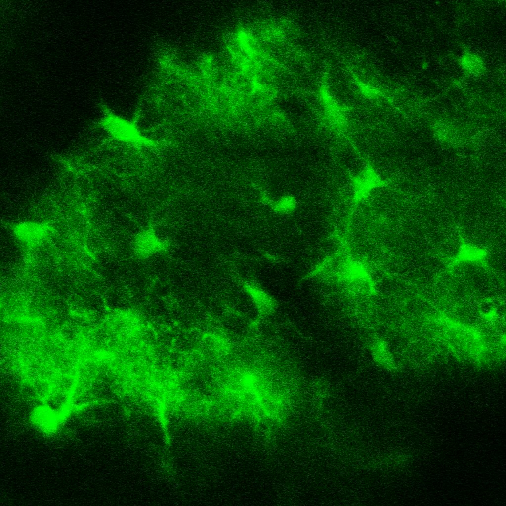 A cloud of Astrocytes shimmers with green fluorescence against a black background