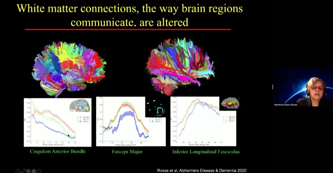 Diana Rosas presents two brains side by side made up of color coded lines