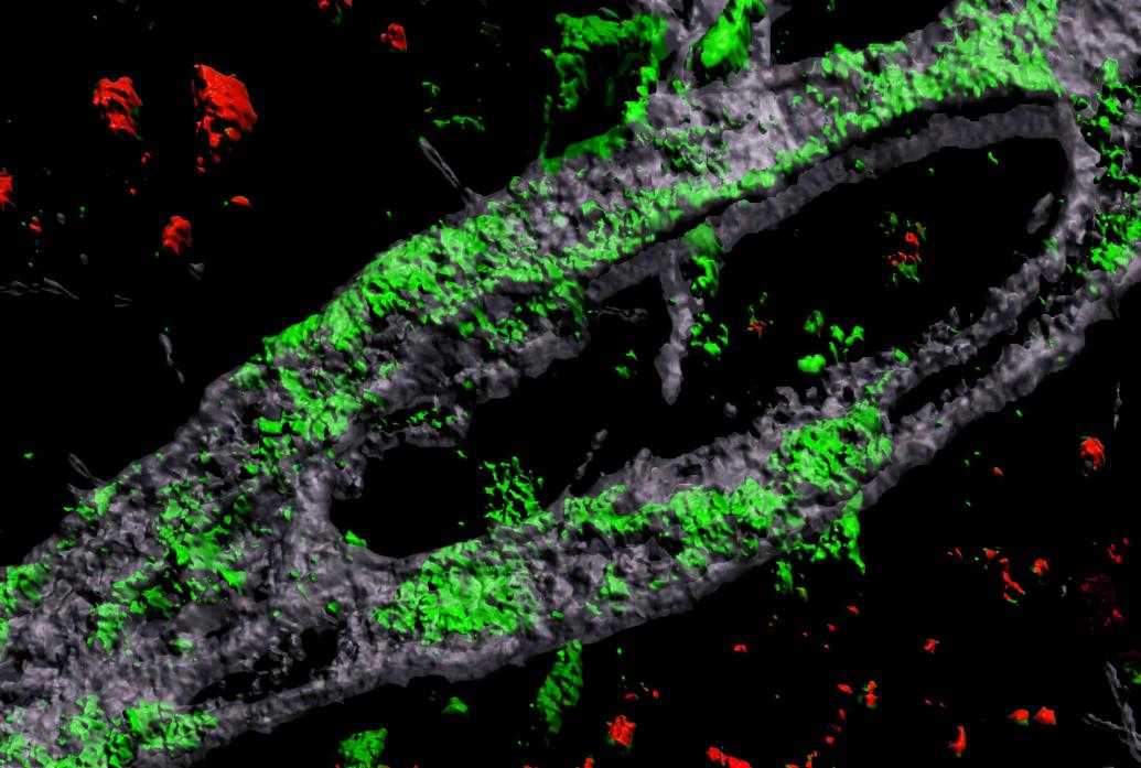 On a black backgound a 3D-looking loop of gray vessel is covered in green blotches