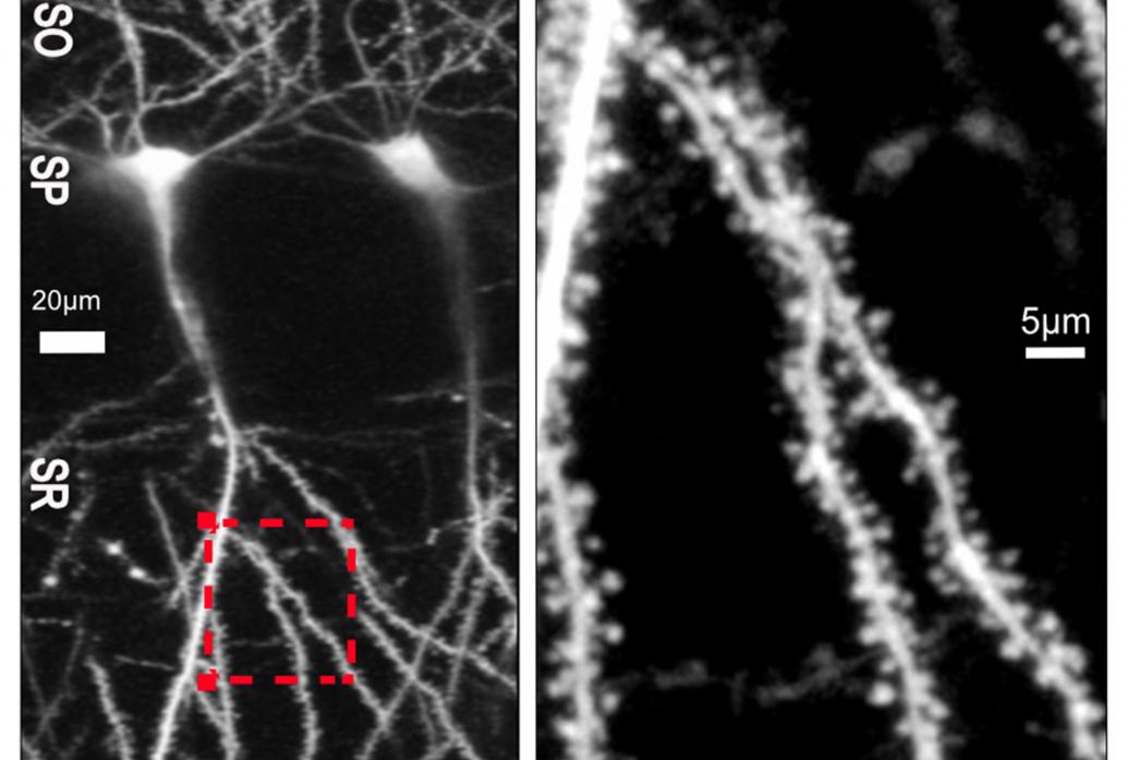 Two black and white panels show a neuron  on the left and a spiny zoomed-in section of its dendrites on the right