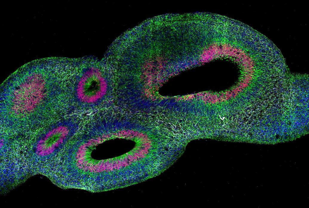 An organoid appears as an elongated, colorful, blob shape with large oblong holes in a few places