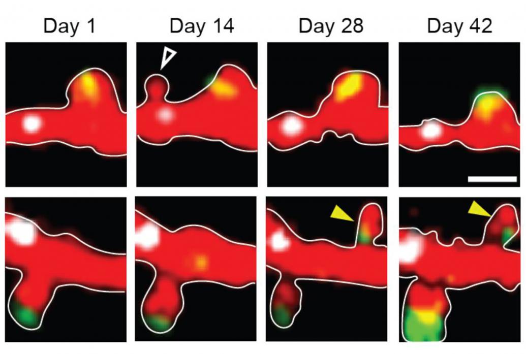 A grid of microscope snapshots shows dendritic spines appearing and disappearing over a 42-day period