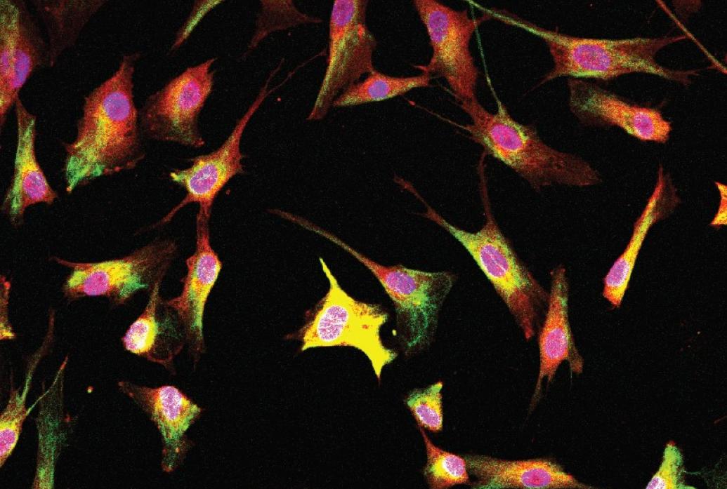 On a black backgorund long spiny cells glow brightly with blue centers and yellow bodies and thin protrusions