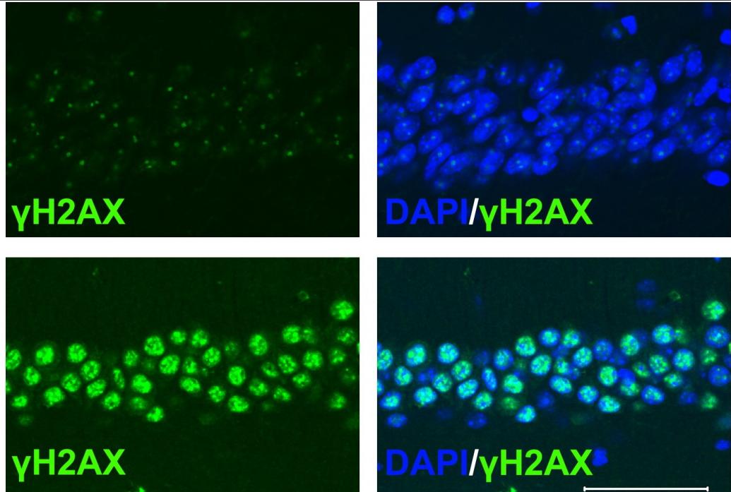 Four panels in a 2 by 2 grid show cells stained in different colors to denote the presence of DNA double-stranded breaks