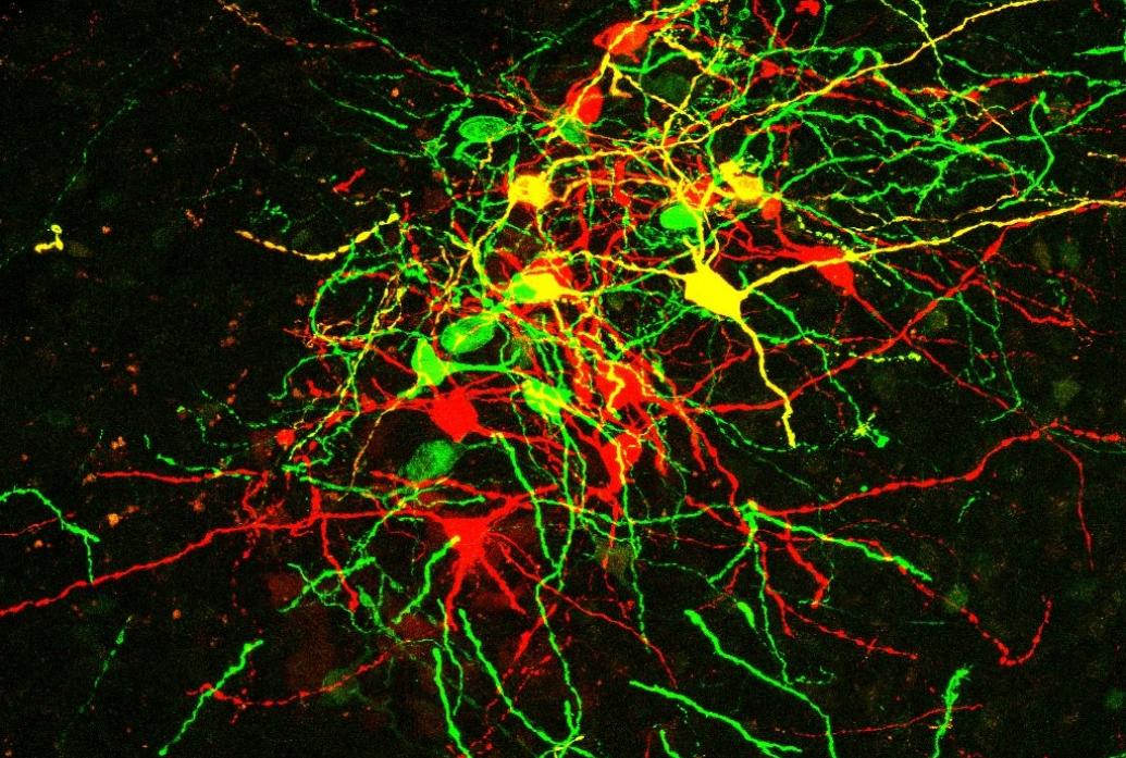 On a black background there is a tangle of red and green stained neurons