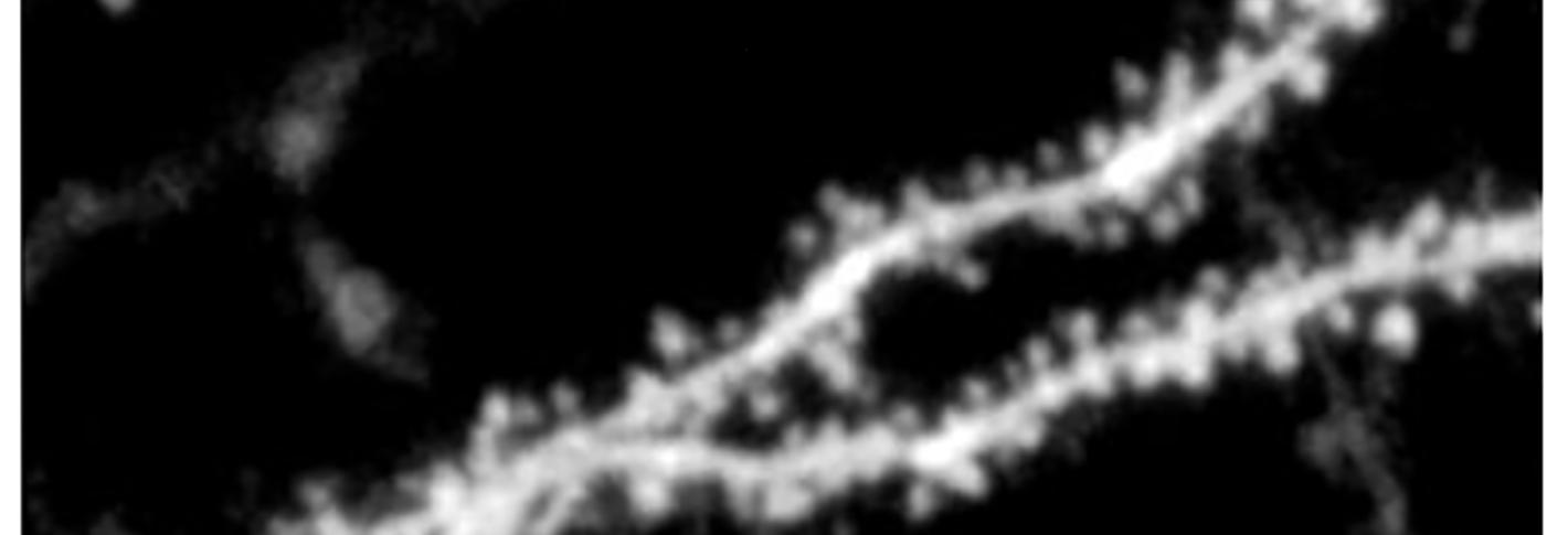 A black and white image shows sections of neural dendrites which appear as long thin lines with many small bumps along them.