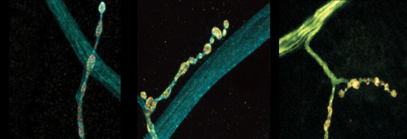 On a black background three panels show a branch of a neuron where there is a thick main part and a thinner protrusion lined with little bulbs. The leftmost panel shows a gray main part with a somewhat yellow protrusion. The middle shows a grey thin part with a very yellow protrusion. In the right panel everything is very yellow.