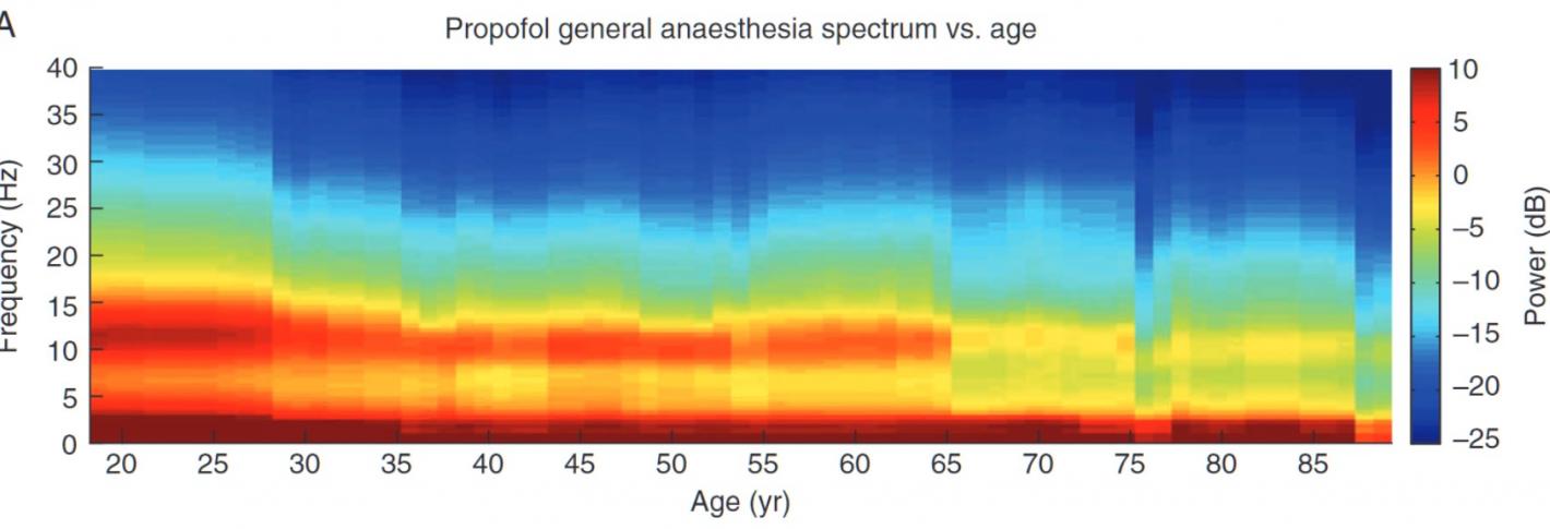 A horizontally oriented plot compares frequency vs. age using color warmth to indicate power. The warmer colors decline in height (frequency) with age.