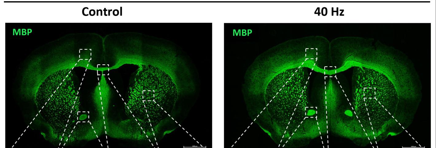 Two green-stained cross sections of a mouse brain, one labeled Cuprizone Control and one labeled Cuprizone 40Hz,, are accompanied by insets showing magnifications of parts specific brain regions. The green staining in each inset is greater and brighter in the 40Hz insets vs. the control insets.