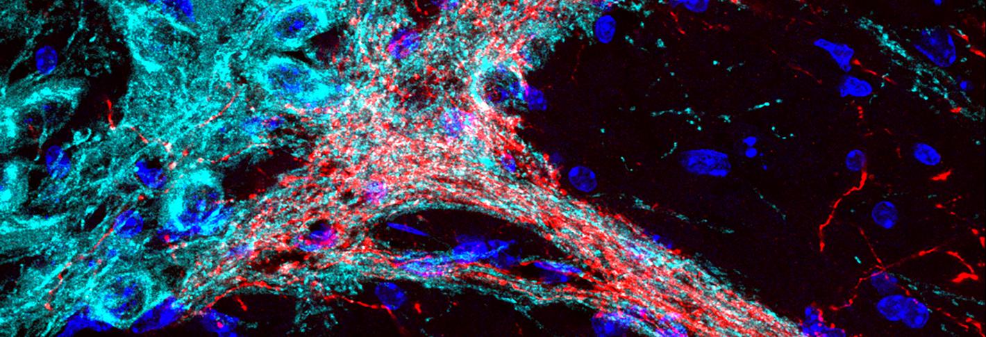 A ensemble of neurons resembling a bouquet of blue cells with a bundle of reddish stems