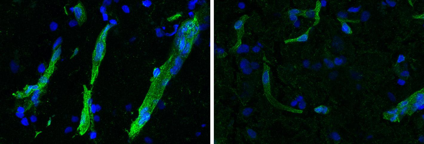 Two panels show diagonal streaks of green stained brain blood vessels over a background of blue cells. The green staining is much brighter in the left panel than in the right.