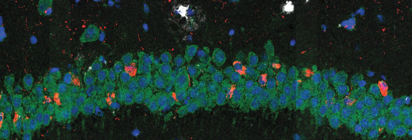 2 microscopy images show blotches of red, blue, green and white on black background. On bottom, green and blue blotches form a horizontal rope-like figure.