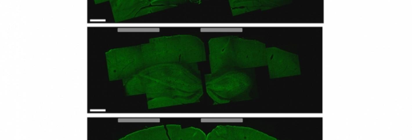 A brain slice that shows the hippocampus cells that were activated by the new stimulation technique (bottom image, lighter green areas on the left)