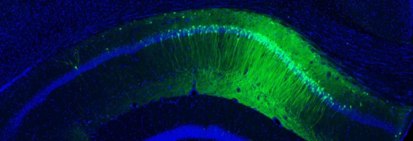 A hippocampal slice with green neurons representing a memory engram