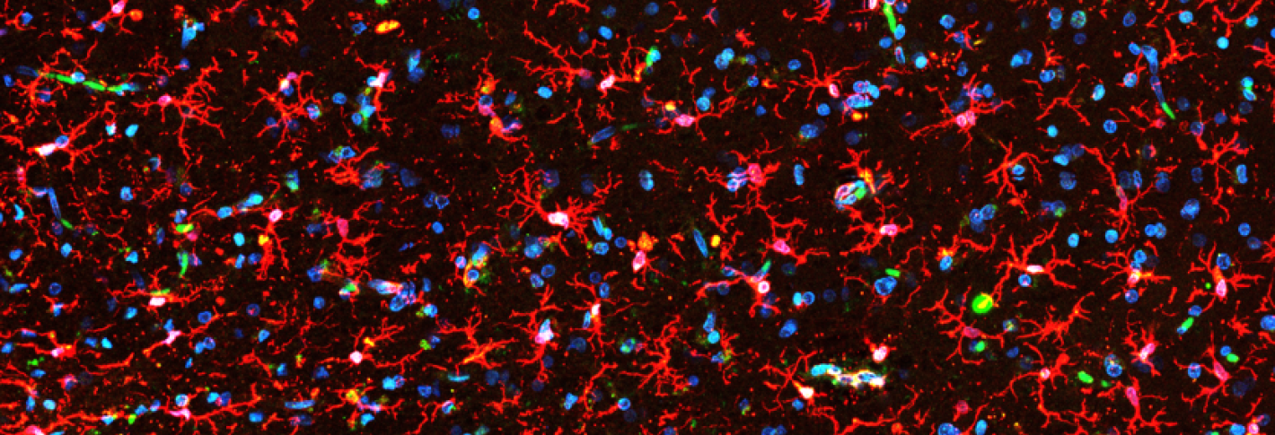 Hundreds of crab-shaped, red-stained microglia, accompanied by the blue-stained nuclei of neurons, cover the field of view against a black background.