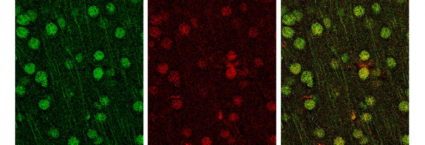 green staining shows MVP protein in neurons