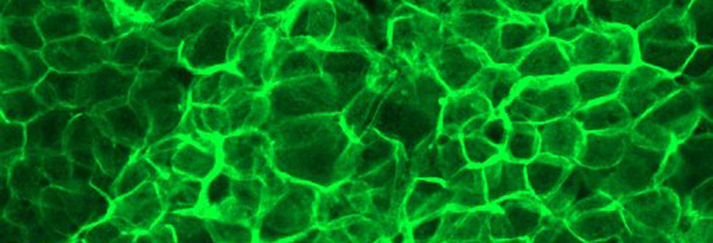 Bright green glow outlines hundreds of cells in a microscope image of tissue