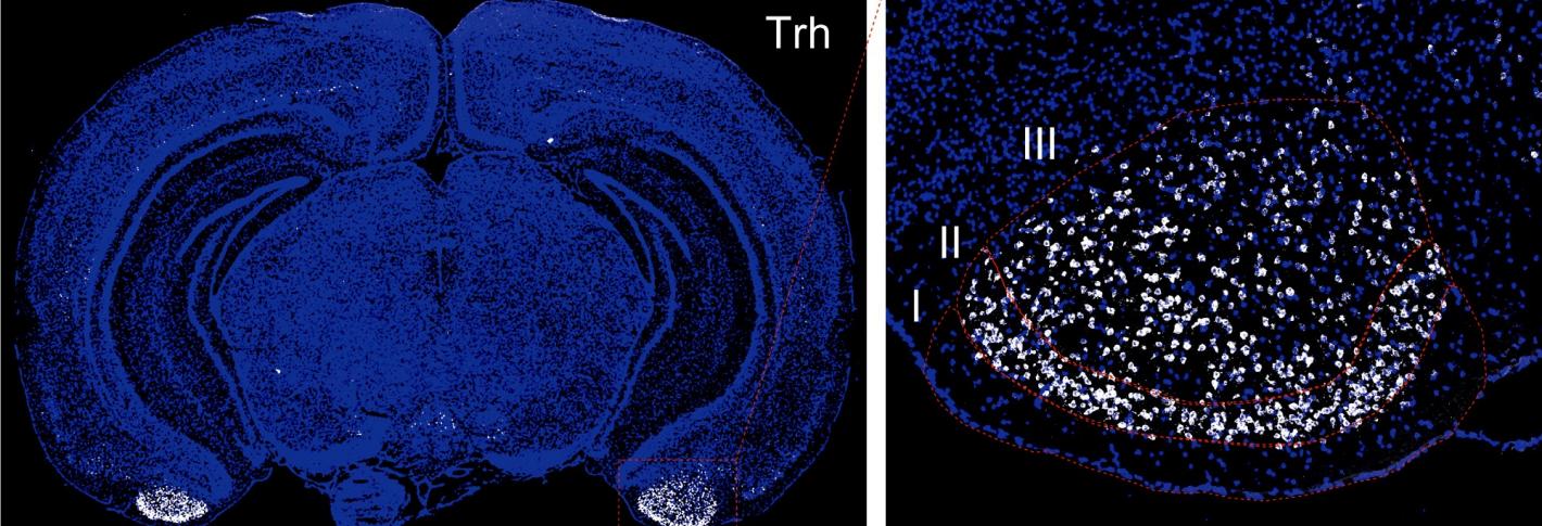 Microscope images show a blue-stained mouse brain. At the bottom on each side are cells shining white. A second panel shows higher magnification of that area