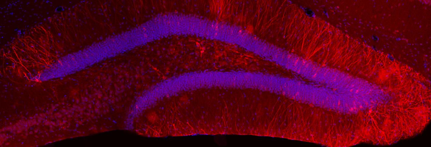 A hippocampus section featuring logn arcs stained blue (as a nuclear marker) and red to indicate the potassium ion channels key to the study