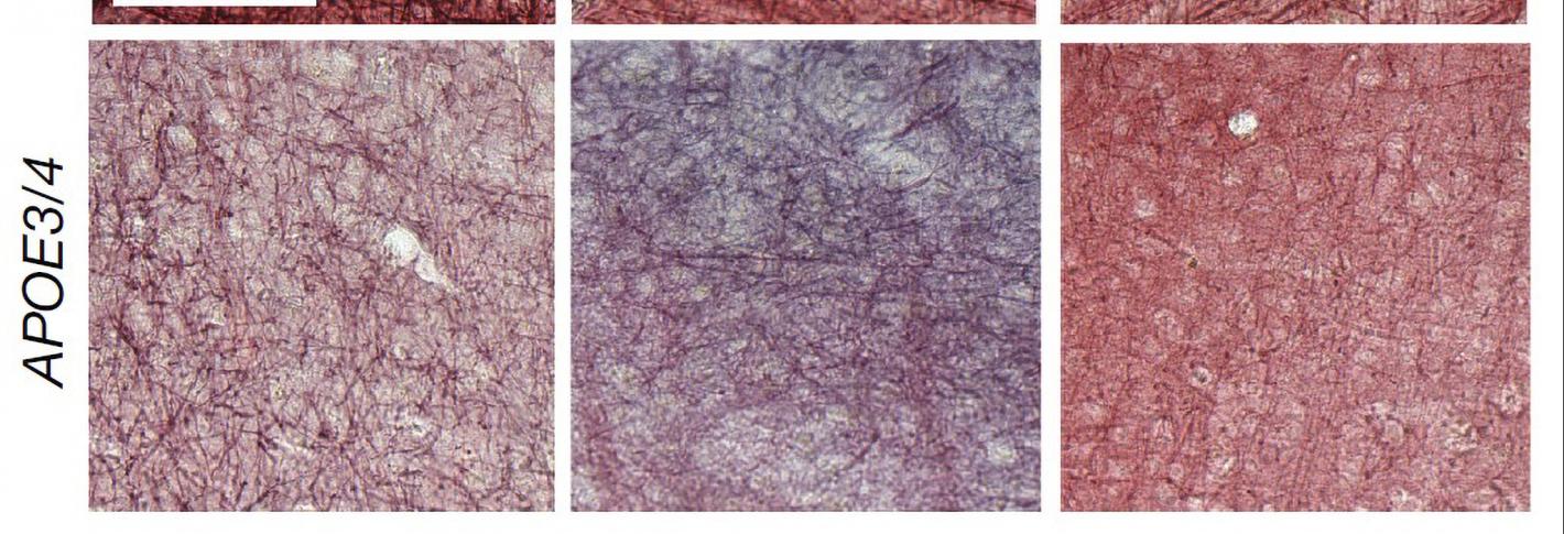 A 3 by 2 array of panels shows a top row of brain tissue squares in which black streaks are very clear. In the bottom row the streaks are less clear.