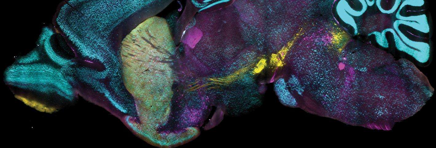 A saggital cross section of a mouse brain is richly stained in three distinct colors in three distinct areas: yellow in the very front and about halfway toward the back; green in a large area toward the front and cyan across wide areas, especially the cerebellum in the back