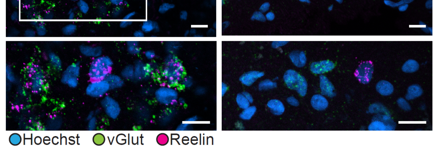 Two panels show blue cells on a black background. Some cells have magenta and green speckles. Below, each panel two subpanels show magnified views.