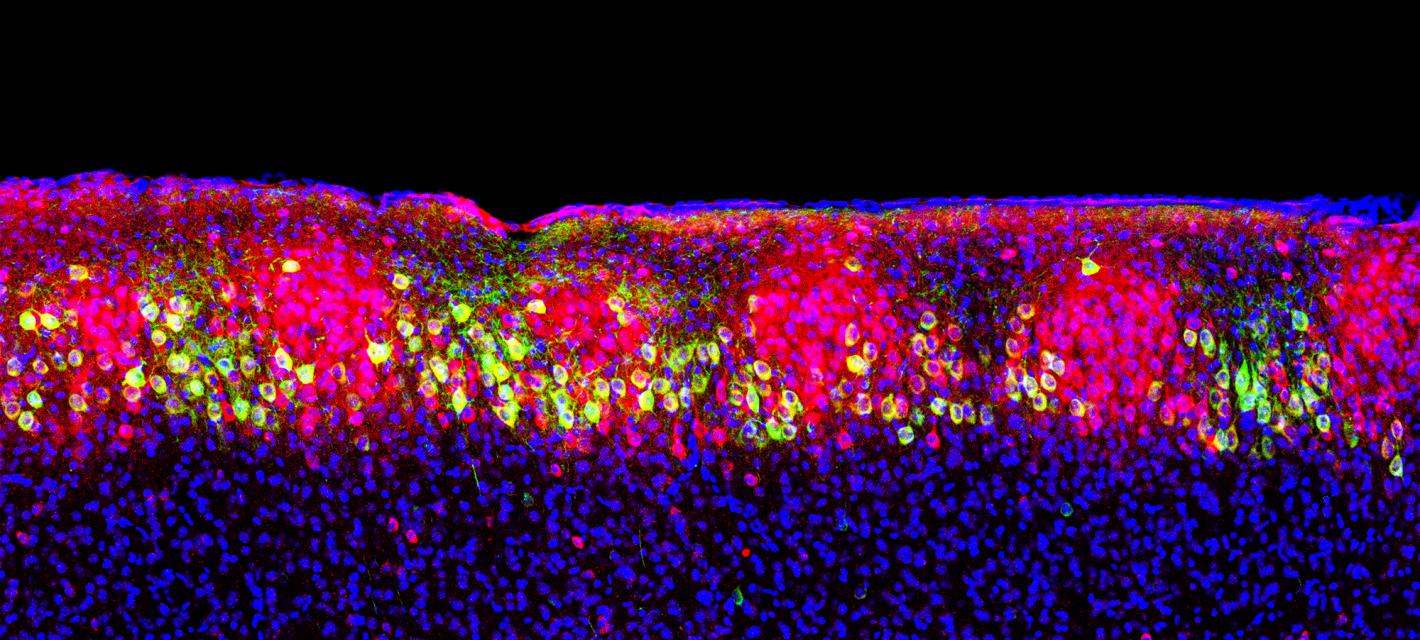 A colored image of a brain slice