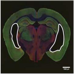 Three mouse brains in a row. White outlines show ventricles, or dark open spaces within