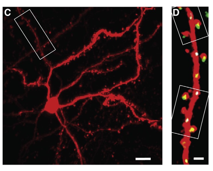 In a square left panel we see a red neuron with sprawling red branches. In a vertical right panel we zoom in on a branch and see little yellow and white spots along its length