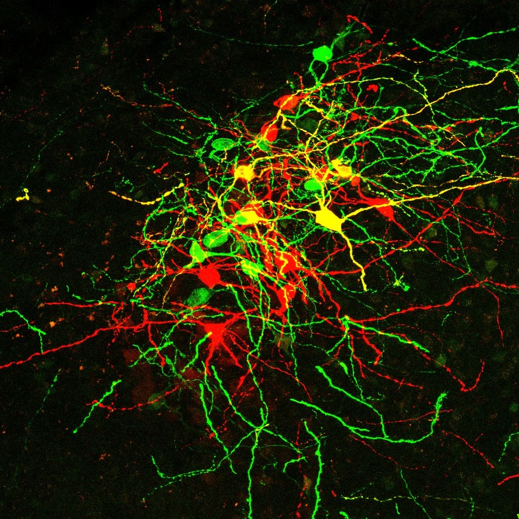 On a black background there is a tangle of red and green stained neurons